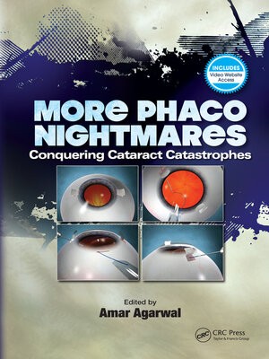 cover image of More Phaco Nightmares